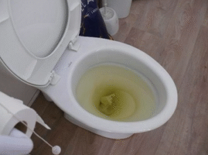 Bồn cầu bị tắc 